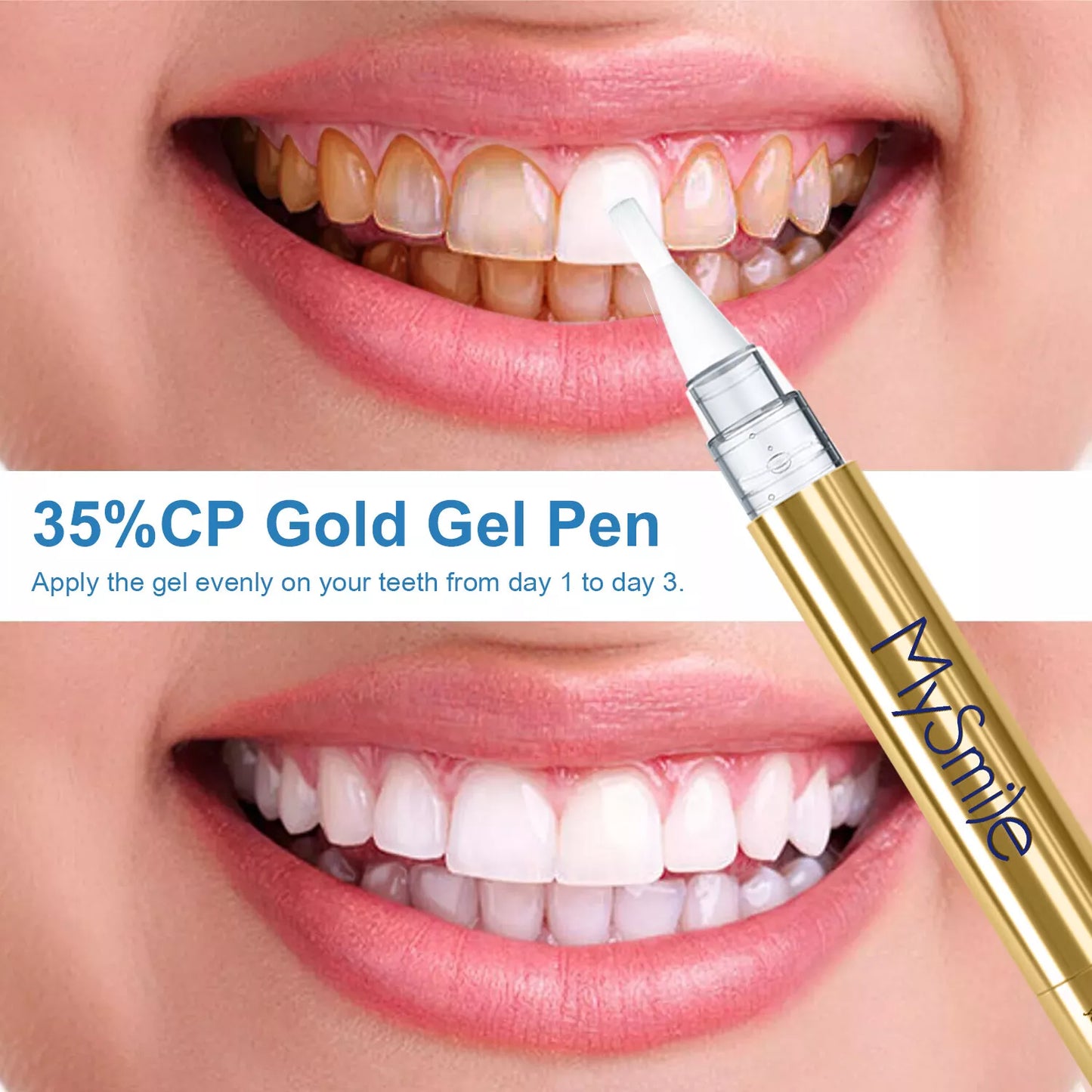Deluxe Teeth Whitening Kit with 28-LED Light, 4X Teeth Whitening Pen Whitening Gel Refills, 10Min Result, Remove 10 Years of Stains