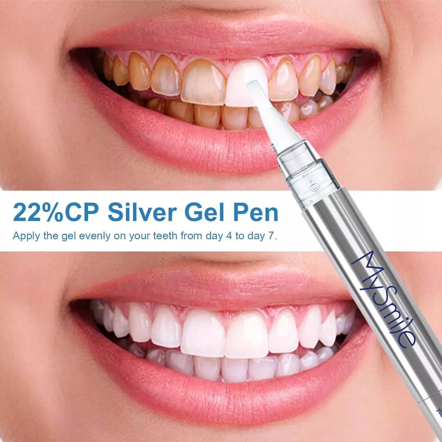 Deluxe Teeth Whitening Kit with 28-LED Light, 4X Teeth Whitening Pen Whitening Gel Refills, 10Min Result, Remove 10 Years of Stains