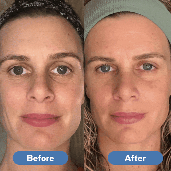 GlowLift™ Microcurrent Facial Massager – Skin Rejuvenation & Anti-Aging Device