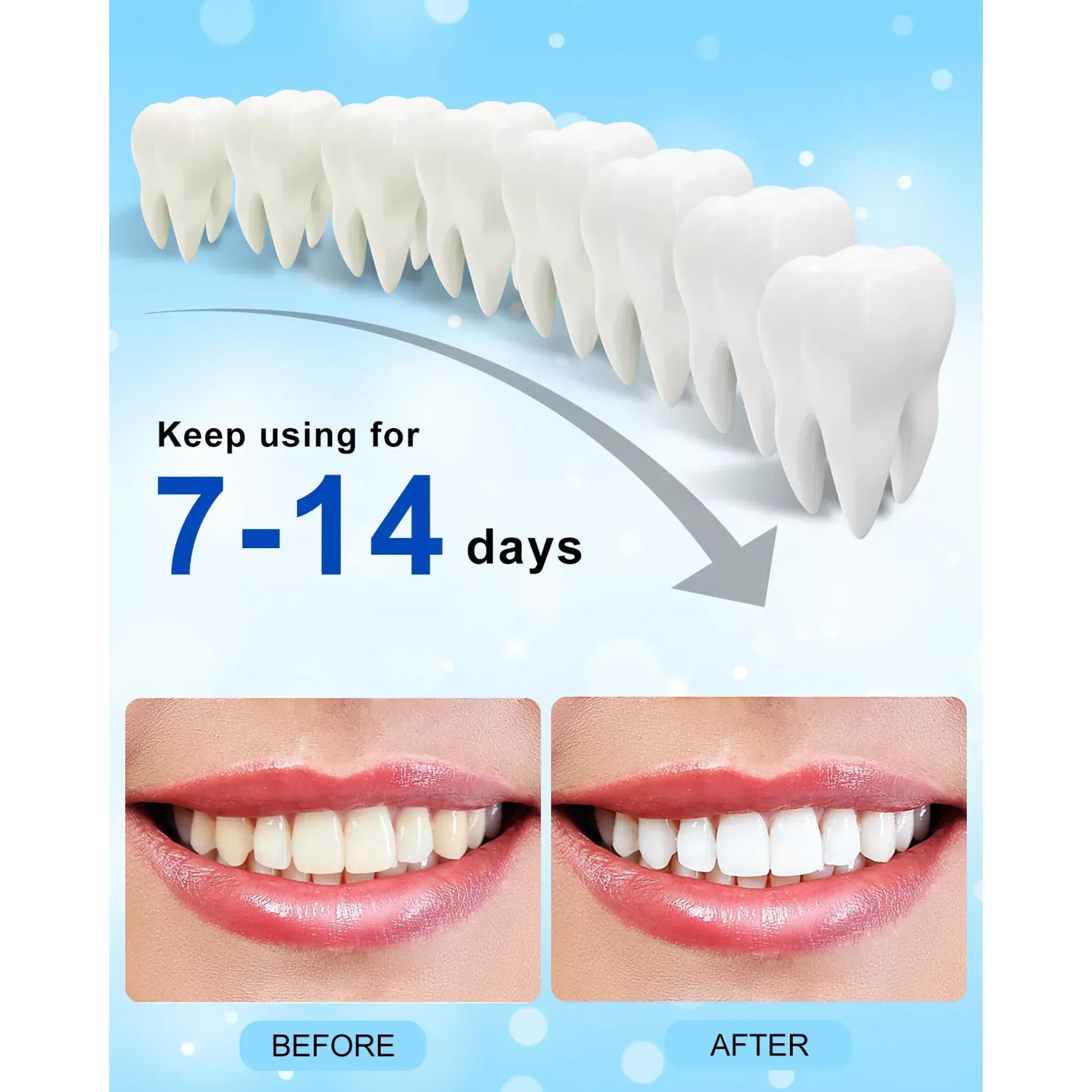 Deluxe Teeth Whitening Kit with 28-LED Light, 4X Teeth Whitening Pen Whitening Gel Refills, 10Min Result, Remove 10 Years of Stains