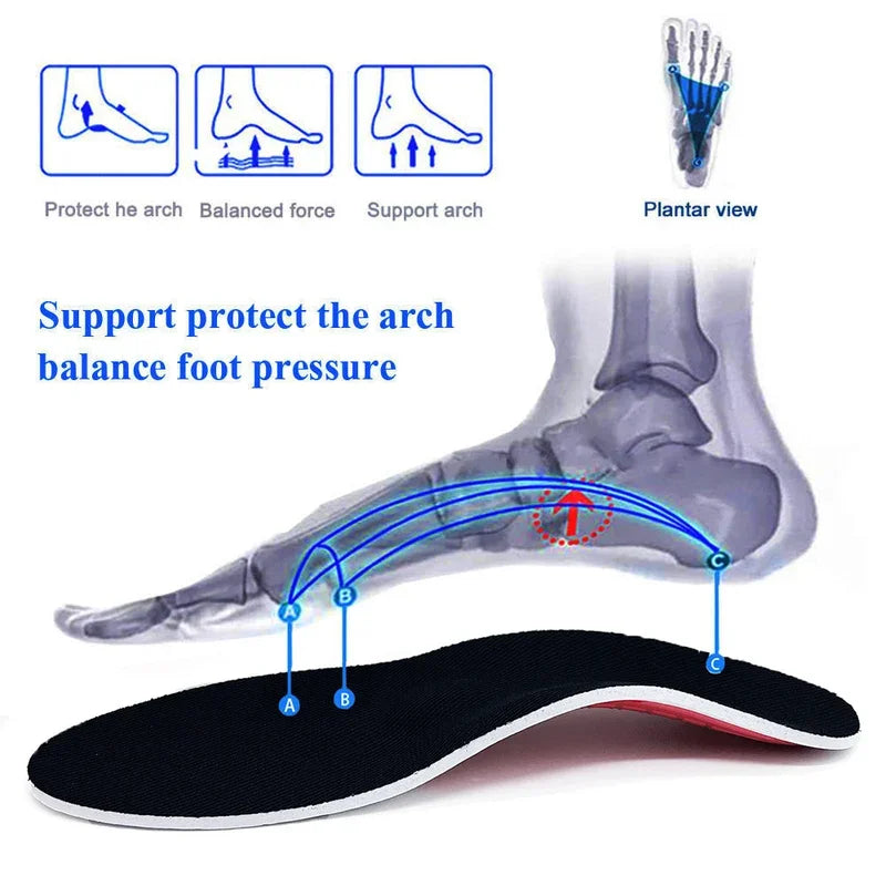 FootAlign™ Orthotic Insoles – Flat Feet Support & Pain Relief