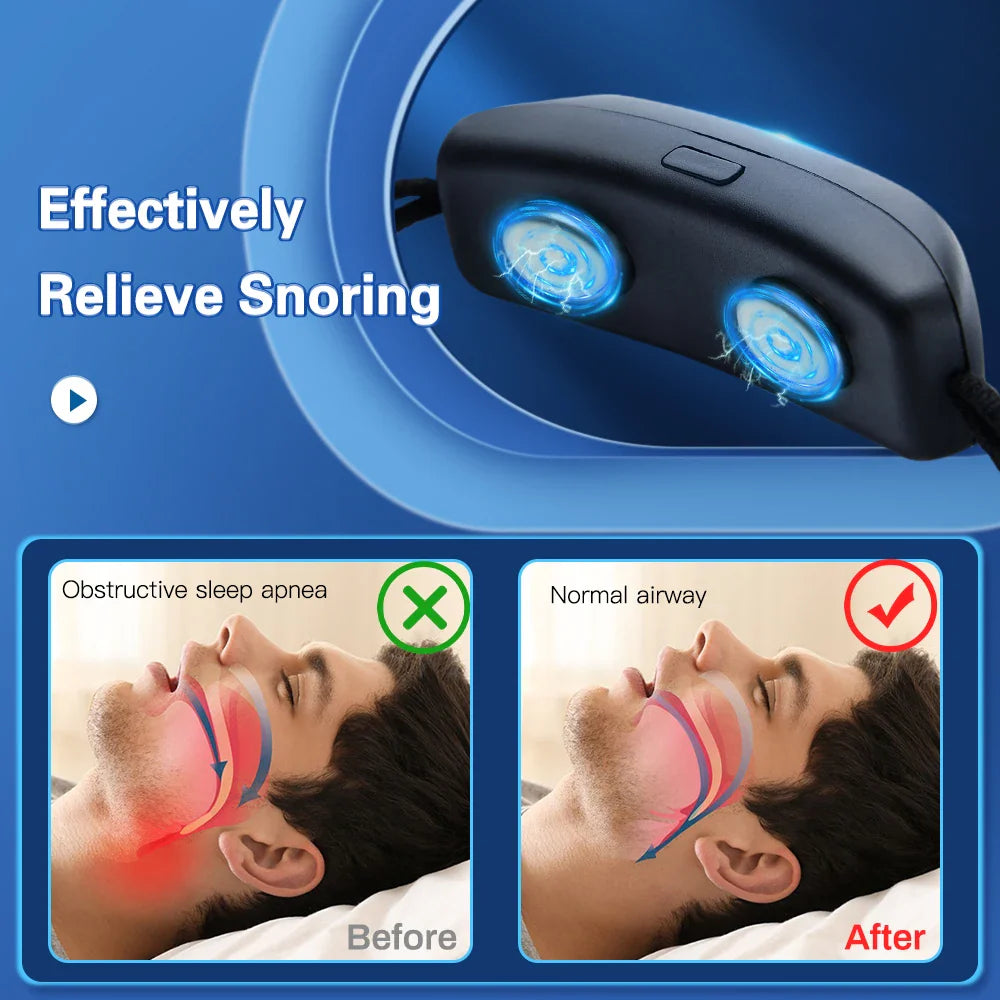 SnoreEase™ EMS Anti-Snoring Device – Smart Breathing Support Stopper
