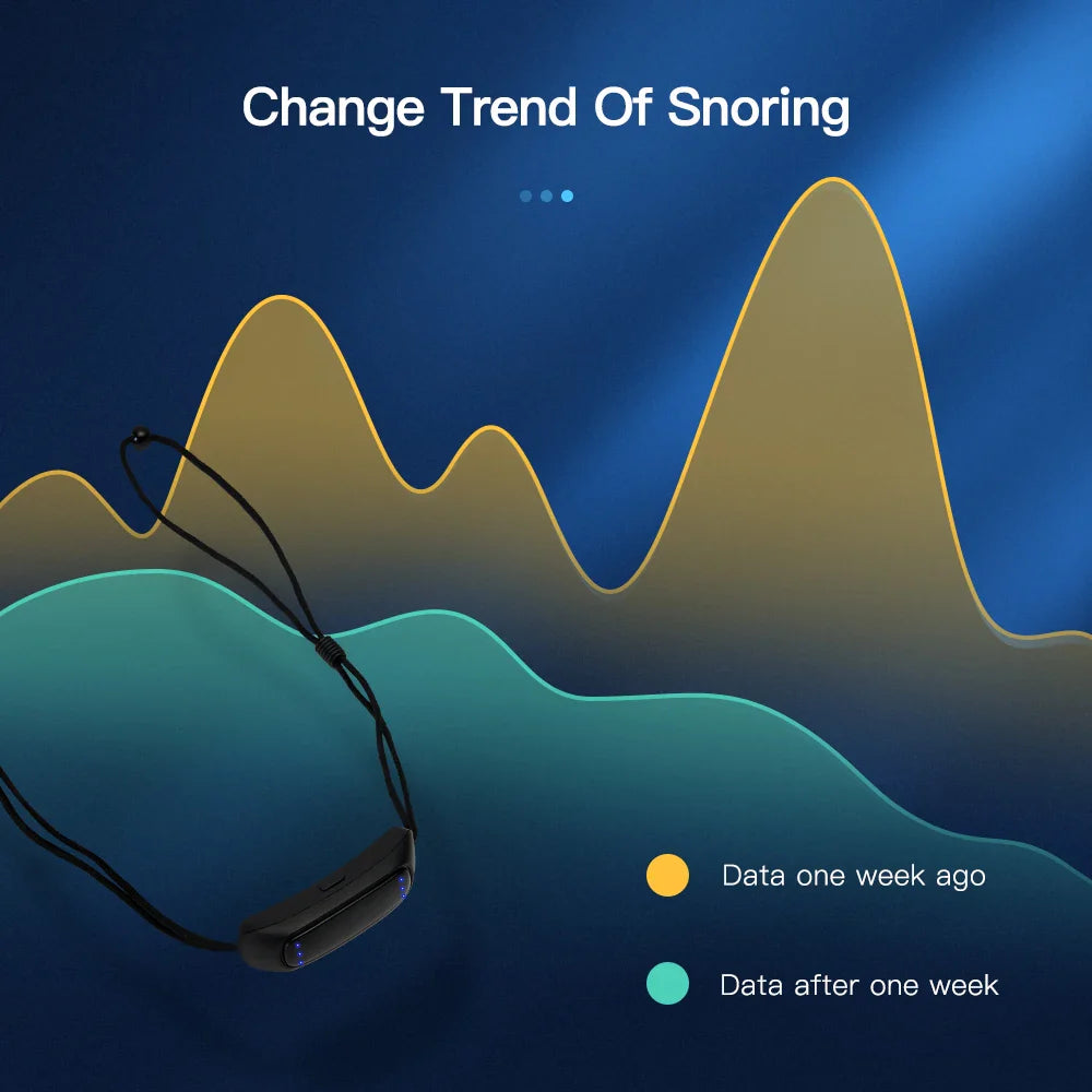 SnoreEase™ EMS Anti-Snoring Device – Smart Breathing Support Stopper