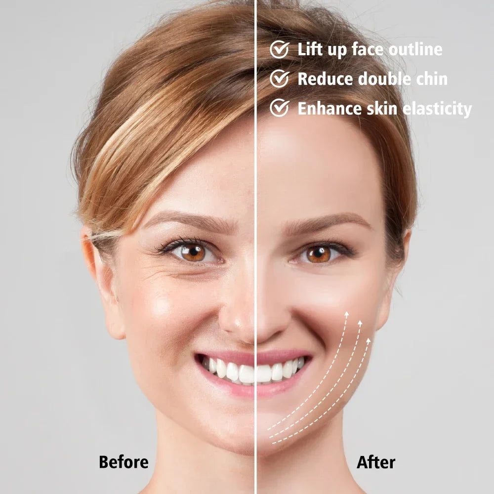 VivaLift™ EMS Face Lifting Massager – V-Face Contouring & Skin Firming Device