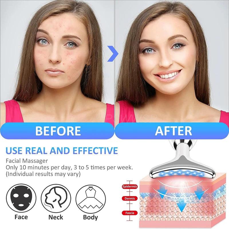 GlowLift™ Microcurrent Facial Massager – Skin Rejuvenation & Anti-Aging Device