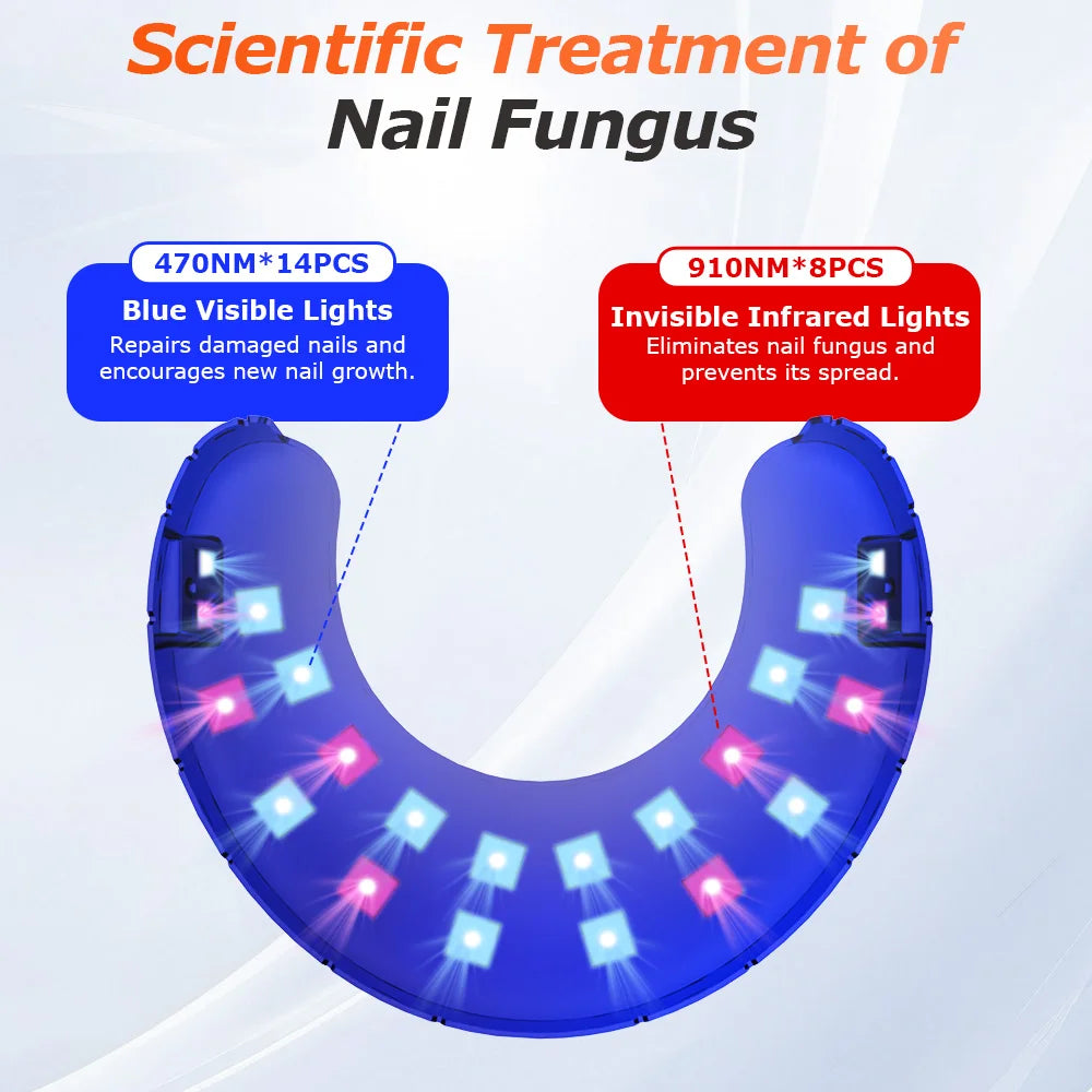 FungiClear™ Wireless Nail Fungus Laser – Foot Care & Nail Health